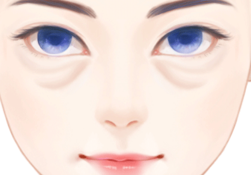 哪里做眼睛整形好？?jī)?yōu)點(diǎn)介紹，眼眼睛整形不踩雷！