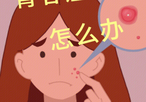 青春痘診療方法，技術(shù)優(yōu)勢有什么？